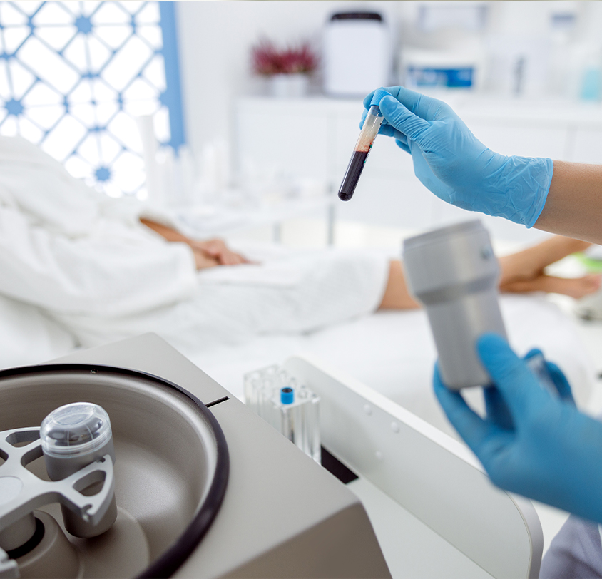 What is PRP Therapy?