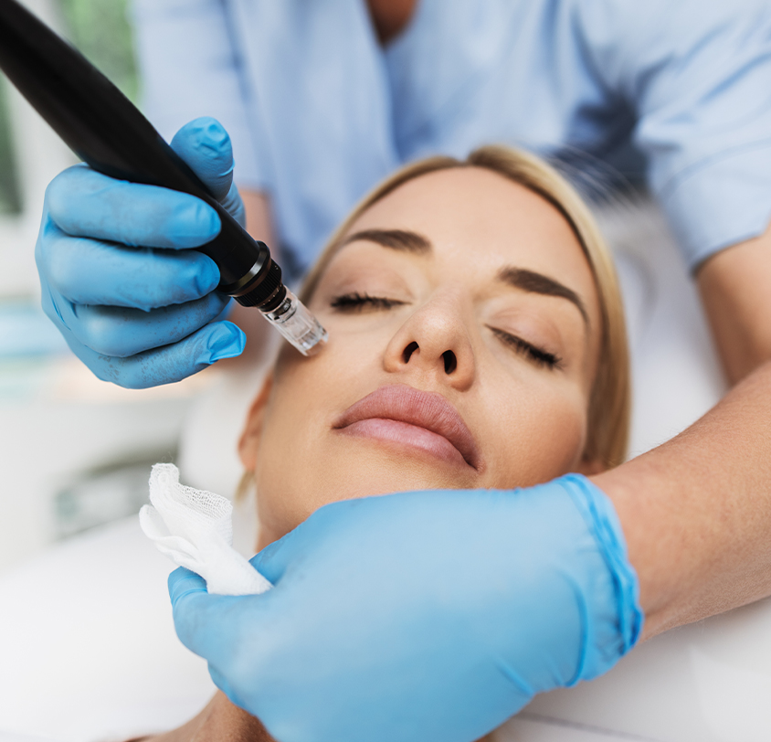 What results can I expect from Microneedling with Hyaluronic Acid?
