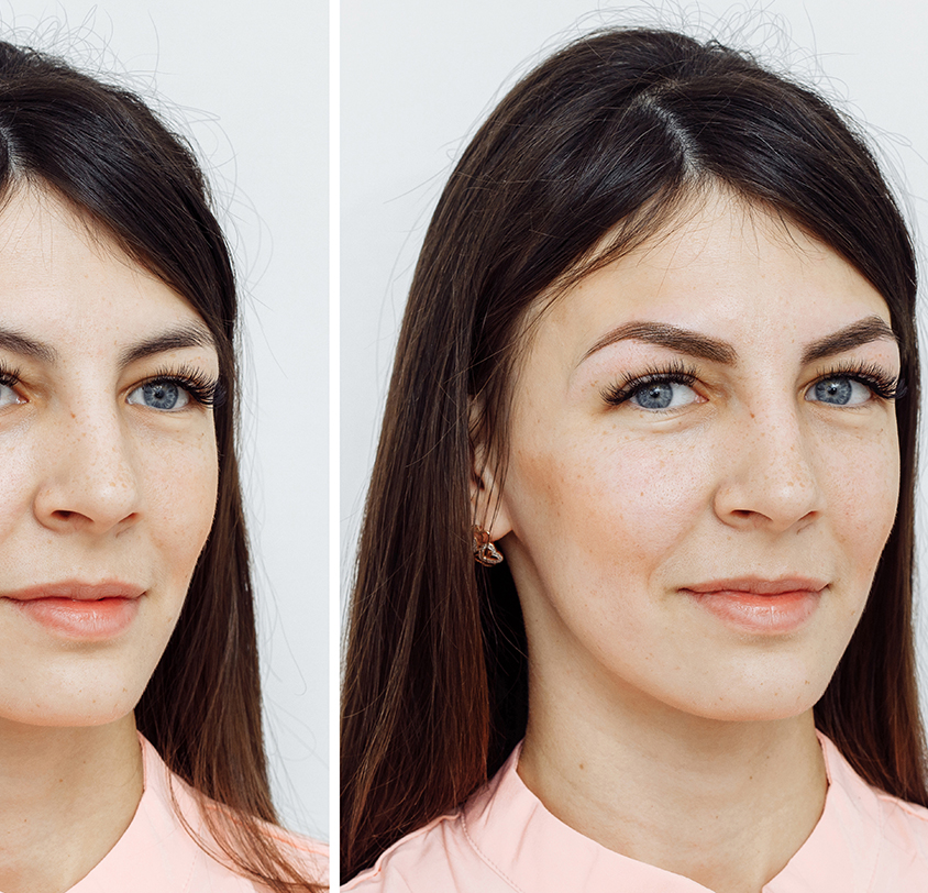 Who is the best candidate for microblading?