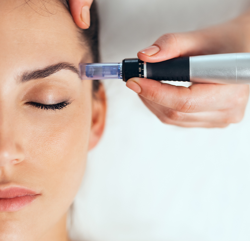 How Does Microneedling with LC Bright and EXO Stem Cells Work?