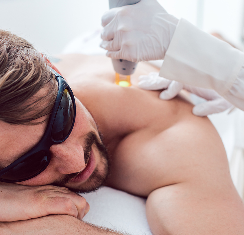 Who is the Ideal Candidate for Laser Hair Removal?
