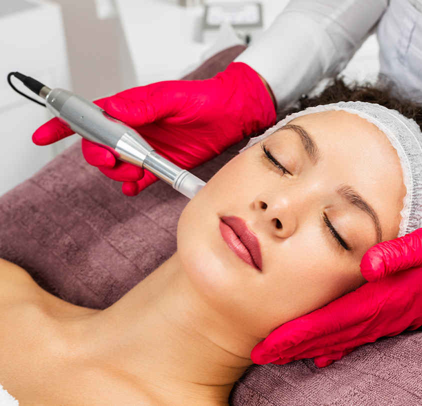 Rejuvenate Your Skin with PRP Microneedling