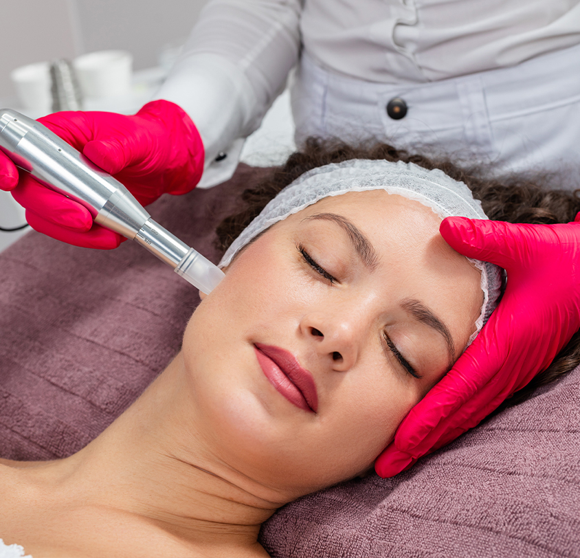 What is Microneedling with Hyaluronic Acid? 