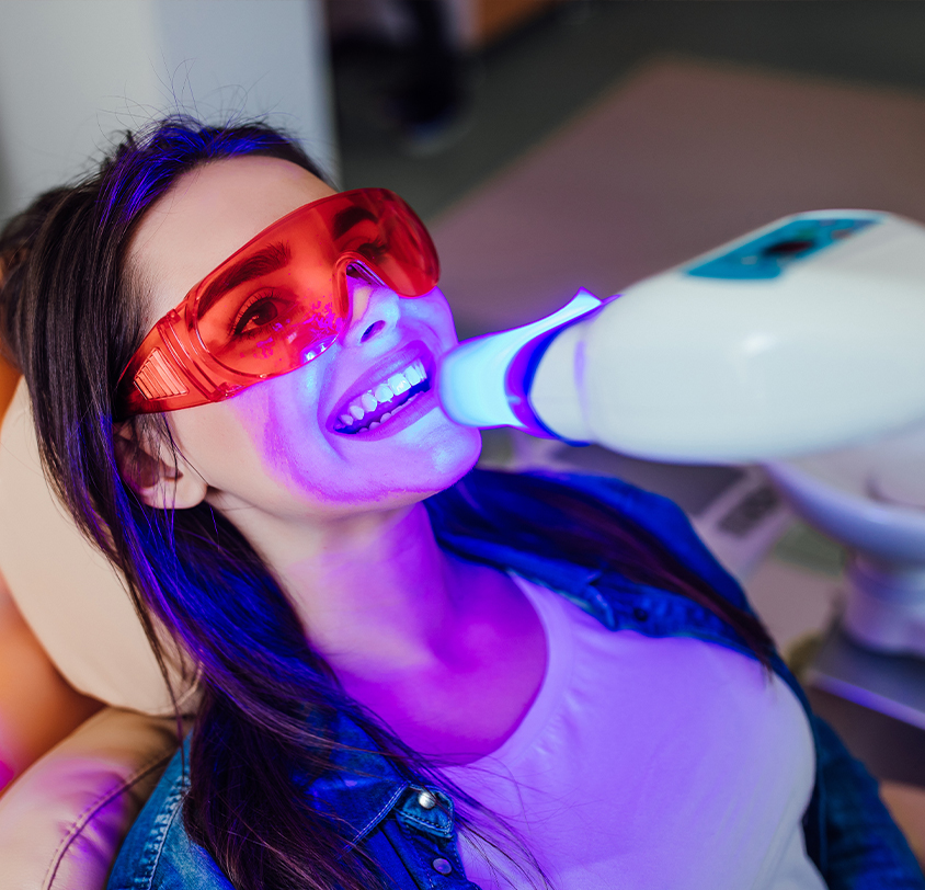 What results can you expect from teeth whitening? 